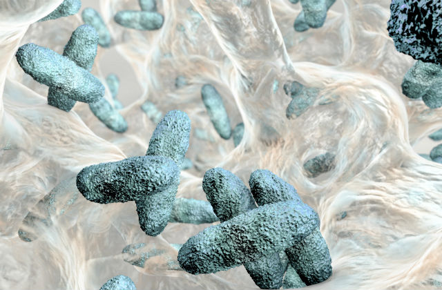 Picture of biofilm containing bacteria Klebsiella